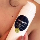 Antioxidáns krém - anyajegyes bőrre